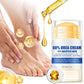 🚫🩸 -50 % ! Crème anti-fissures : comble, nourrit en profondeur et élimine les callosités. Plus de gêne en sandales !