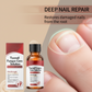 🔥 Vente flash à durée limitée, moitié prix 💅🏻 Huile réparatrice pour ongles abîmés (1 achetée = 1 offerte) – résultats rapides ; fortifie et répare les ongles fragiles ✨🖤