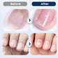 💅🧴 PROMO Spray réparateur nourrissant pour ongles fragiles ✨